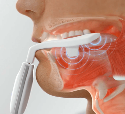 Diagram of the ExciteOSA mouthpiece stimulating the tongue muscle
