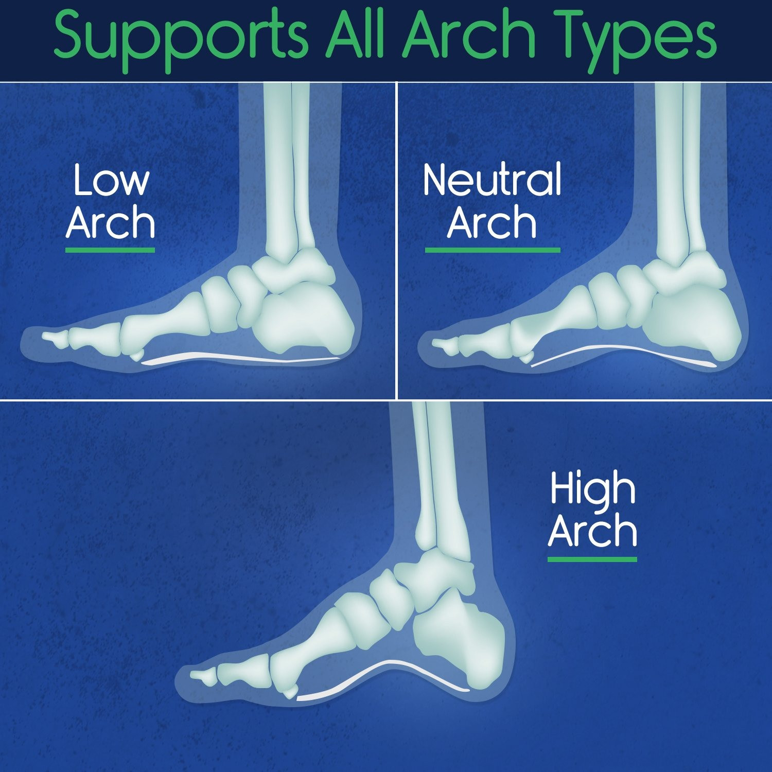 Plantar Plus Full Length Insoles photo 3
